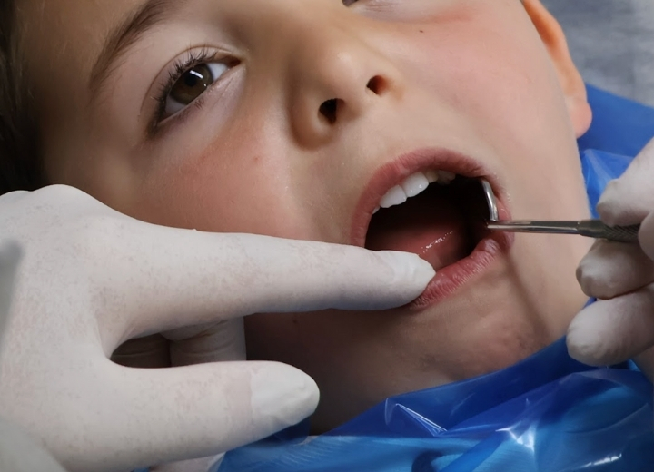 Dientes en el paladar. Ortodoncia niños Gijón